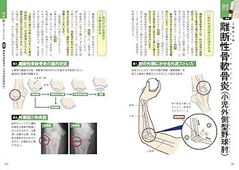 投球障害0へ! ゼロポジションでつくる最強の肩と肘 | 西中 直也